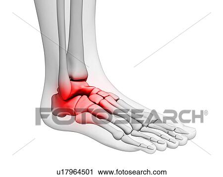 Human ankle pain, artwork View Large Illustration Clip Art - Human ankle pain, artwork. Fotosearch