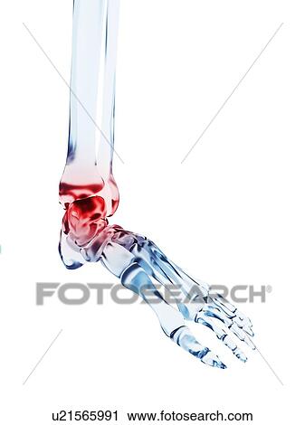 Human ankle pain, artwork View Large Illustration Clip Art - Human ankle pain, artwork. Fotosearch