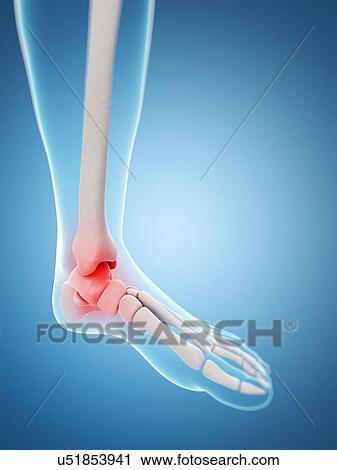 Human ankle pain, artwork View Large Illustration Clip Art - Human ankle pain, artwork. Fotosearch