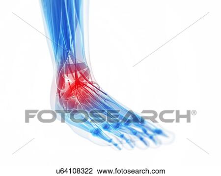 Human ankle pain, artwork View Large Illustration Drawing - Human ankle pain, artwork. Fotosearch