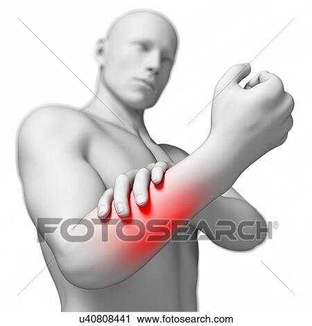 Human arm pain, artwork View Large Illustration Clip Art - Human arm pain, artwork. Fotosearch