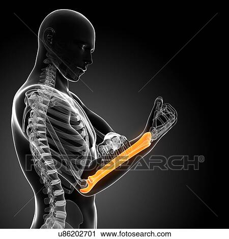 Human arm pain, artwork View Large Illustration Clip Art - Human arm pain, artwork. Fotosearch