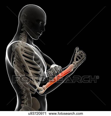 Human arm pain, artwork View Large Illustration Clip Art - Human arm pain, artwork. Fotosearch