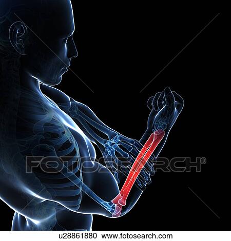 Human arm pain, artwork View Large Illustration Clipart - Human arm pain, artwork. Fotosearch