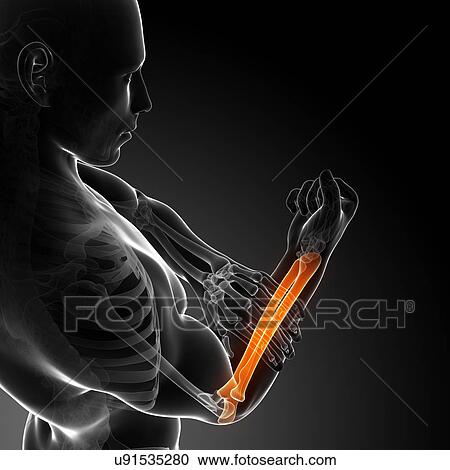 Clipart - Human arm pain, artwork. Fotosearch
