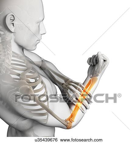 Stock Illustration - Human arm pain, artwork. Fotosearch