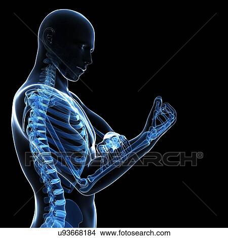Human arm pain, artwork View Large Illustration Stock Illustration - Human arm pain, artwork. Fotosearch