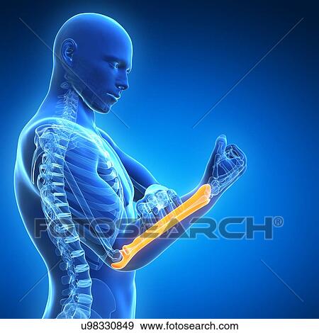 Human arm pain, artwork View Large Illustration Stock Illustration - Human arm pain, artwork. Fotosearch