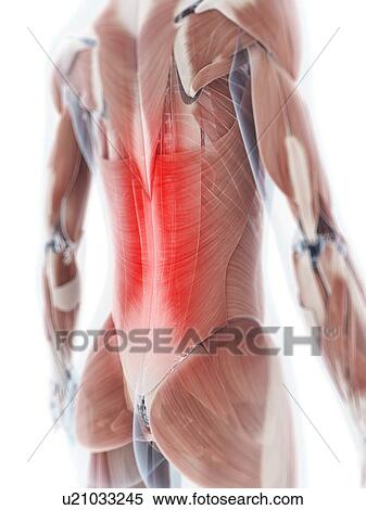Stock Illustration - Human back muscle pain, artwork. Fotosearch
