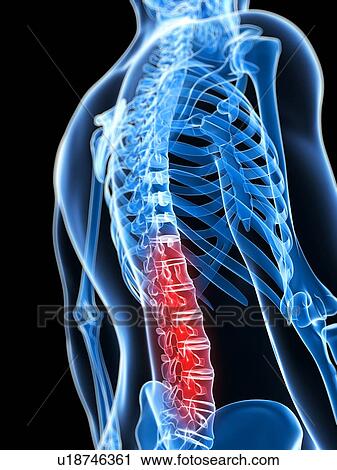 Human back pain, artwork View Large Illustration Clip Art - Human back pain, artwork. Fotosearch