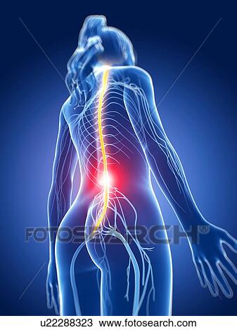 Drawing - Human back pain, artwork. Fotosearch