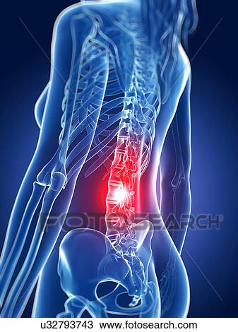 Human back pain, artwork View Large Illustration Drawing - Human back pain, artwork. Fotosearch