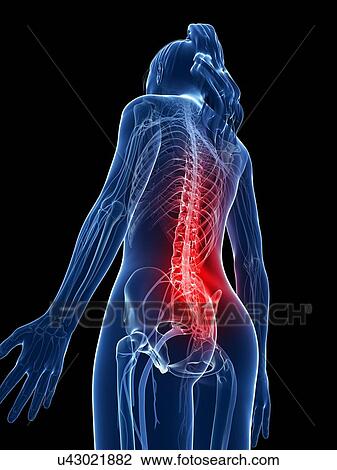 Drawing - Human back pain, artwork. Fotosearch