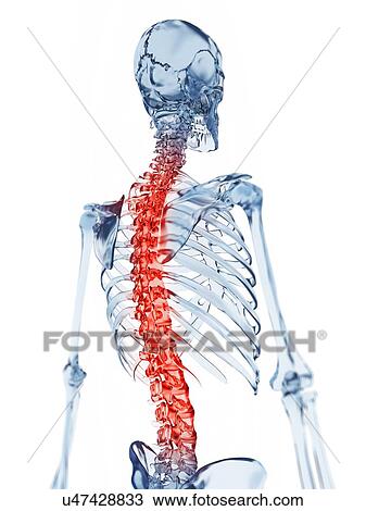 Drawing - Human back pain, artwork. Fotosearch