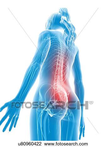 Human back pain, artwork View Large Illustration Drawing - Human back pain, artwork. Fotosearch