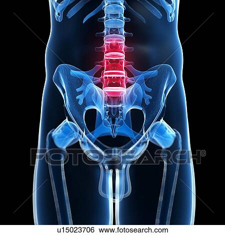 Human back pain, artwork View Large Illustration Stock Illustration - Human back pain, artwork. Fotosearch