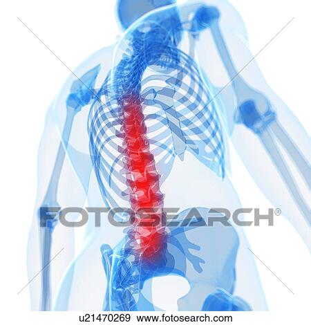 Human back pain, artwork View Large Illustration Stock Illustration - Human back pain, artwork. Fotosearch