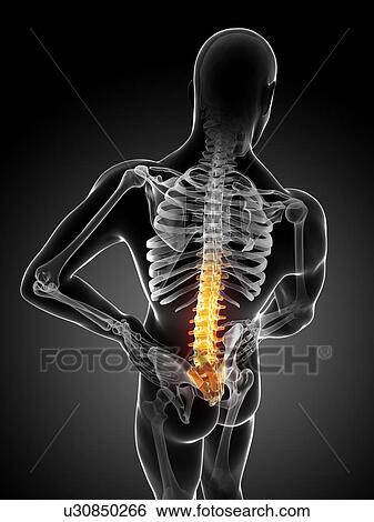 Human back pain, artwork View Large Illustration Stock Illustration - Human back pain, artwork. Fotosearch