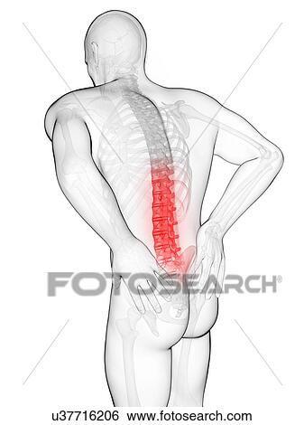 Human back pain, artwork View Large Illustration Stock Illustration - Human back pain, artwork. Fotosearch