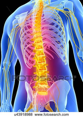 Stock Illustration - Human back pain, artwork. Fotosearch