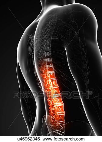 Human back pain, artwork View Large Illustration Stock Illustration - Human back pain, artwork. Fotosearch