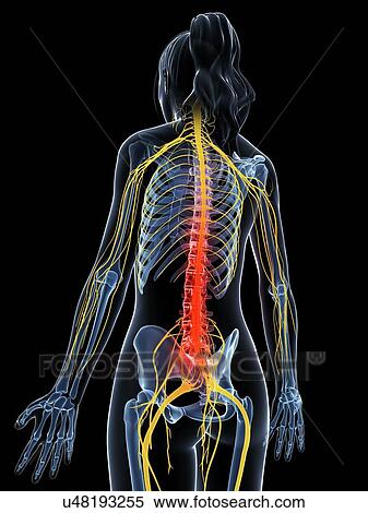 Stock Illustration - Human back pain, artwork. Fotosearch
