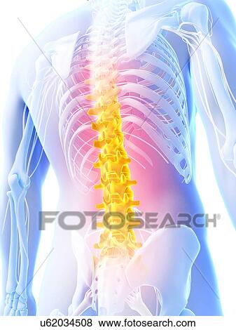 Human back pain, artwork View Large Illustration Stock Illustration - Human back pain, artwork. Fotosearch