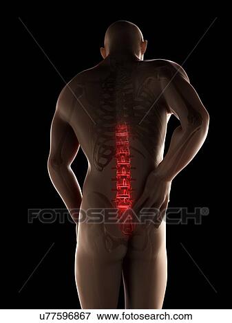 Human back pain, artwork View Large Illustration Stock Illustration - Human back pain, artwork. Fotosearch