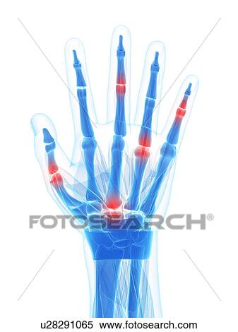 Human finger joints, artwork View Large Illustration Stock Illustration - Human finger joints, artwork. Fotosearch