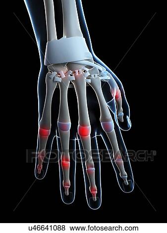Human finger joints, artwork View Large Illustration Stock Illustration - Human finger joints, artwork. Fotosearch