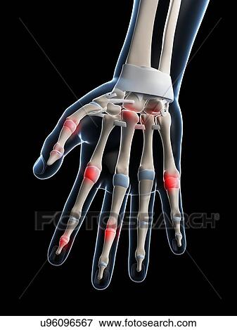 Human finger joints, artwork View Large Illustration Stock Illustration - Human finger joints, artwork. Fotosearch