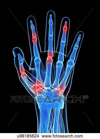 Human finger joints, artwork View Large Illustration Stock Illustration - Human finger joints, artwork. Fotosearch