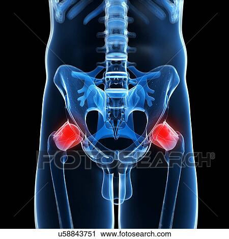Human hip pain, artwork View Large Illustration Clip Art - Human hip pain, artwork. Fotosearch