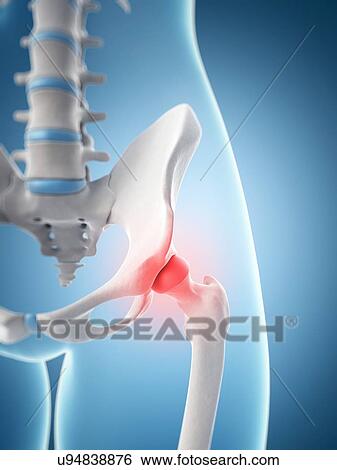 Human hip pain, artwork View Large Illustration Stock Illustration - Human hip pain, artwork. Fotosearch