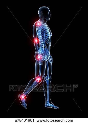 Human joint pain, artwork View Large Illustration Clip Art - Human joint pain, artwork. Fotosearch