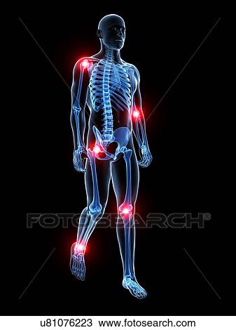 Human joint pain, artwork View Large Illustration Drawing - Human joint pain, artwork. Fotosearch