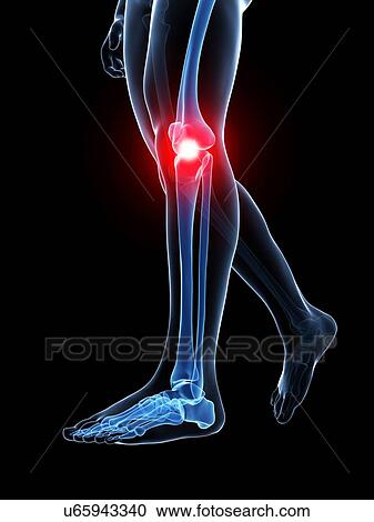 Human knee pain, artwork View Large Illustration Clipart - Human knee pain, artwork. Fotosearch