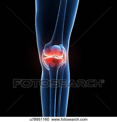 Human knee pain, artwork View Large Illustration Clipart - Human knee pain, artwork. Fotosearch