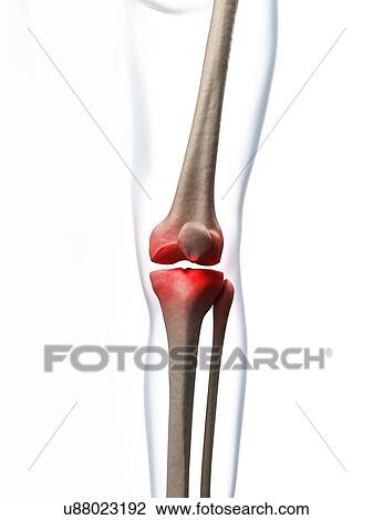 Human knee pain, artwork View Large Illustration Drawing - Human knee pain, artwork. Fotosearch