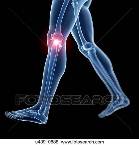 Human knee pain, artwork View Large Illustration Stock Illustration - Human knee pain, artwork. Fotosearch