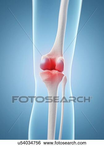 Human knee pain, artwork View Large Illustration Stock Illustration - Human knee pain, artwork. Fotosearch