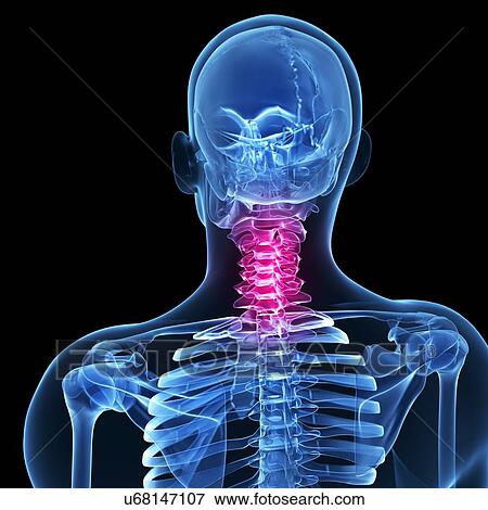 Human neck bones, artwork View Large Illustration Stock Illustration - Human neck bones, artwork. Fotosearch