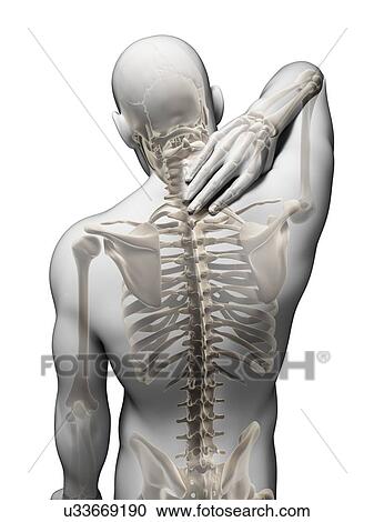 Clipart - Human neck pain, artwork. Fotosearch