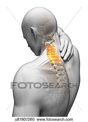 Human neck pain, artwork View Large Illustration Clipart - Human neck pain, artwork. Fotosearch
