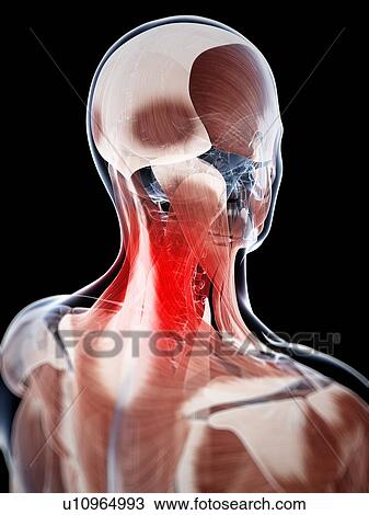 Drawing - Human neck pain, artwork. Fotosearch