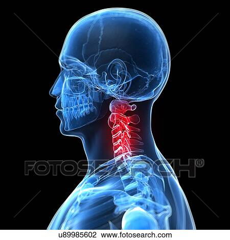 Human neck pain, artwork View Large Illustration Drawing - Human neck pain, artwork. Fotosearch