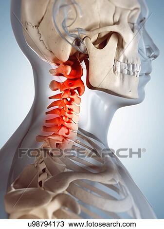 Drawing - Human neck pain, artwork. Fotosearch