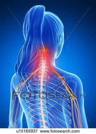 Human neck pain, artwork View Large Illustration Stock Illustration - Human neck pain, artwork. Fotosearch