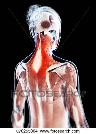 Human neck pain, artwork View Large Illustration Stock Illustration - Human neck pain, artwork. Fotosearch