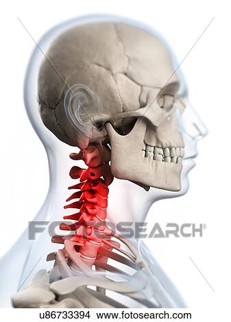 Human neck pain, artwork View Large Illustration Stock Illustration - Human neck pain, artwork. Fotosearch